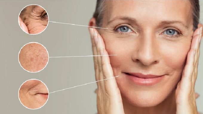 Nâng Cơ, Trẻ Hóa Da Mặt Nhanh, An Toàn Chuẩn Y Khoa HCM 20 Da lão hóa là hiện tượng da mất đi độ đàn hồi, săn chắc, xuất hiện nếp nhăn, chảy xệ, nám, tàn nhang