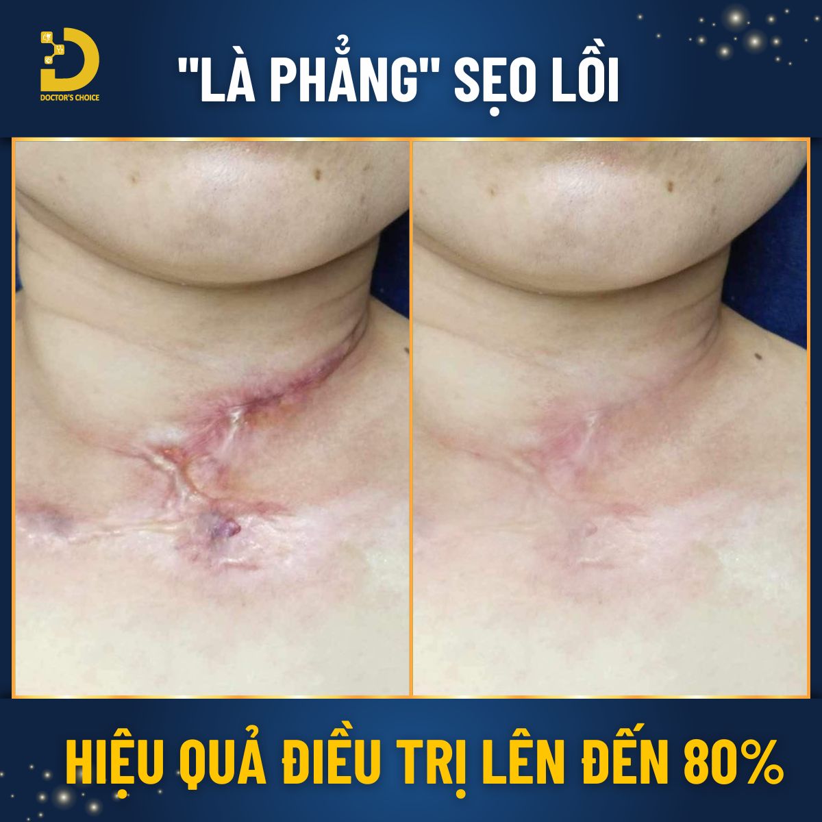 Phòng khám trị sẹo lồi, sẹp phì đại tại TPHCM an toàn, hiệu quả 25 Doctor's Choice Clinic tự hào với nhiều năm kinh nghiệm chuyên sâu trong lĩnh vực điều trị sẹo lồi