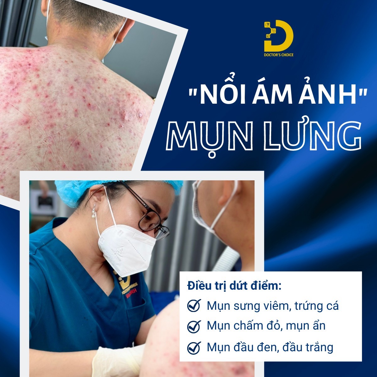 Điều Trị Mụn Lưng An Toàn, Vệ Sinh Chuẩn Y Khoa TPHCM 15 Dịch vụ điều trị mụn lưng tận gốc, dứt điểm, an toàn