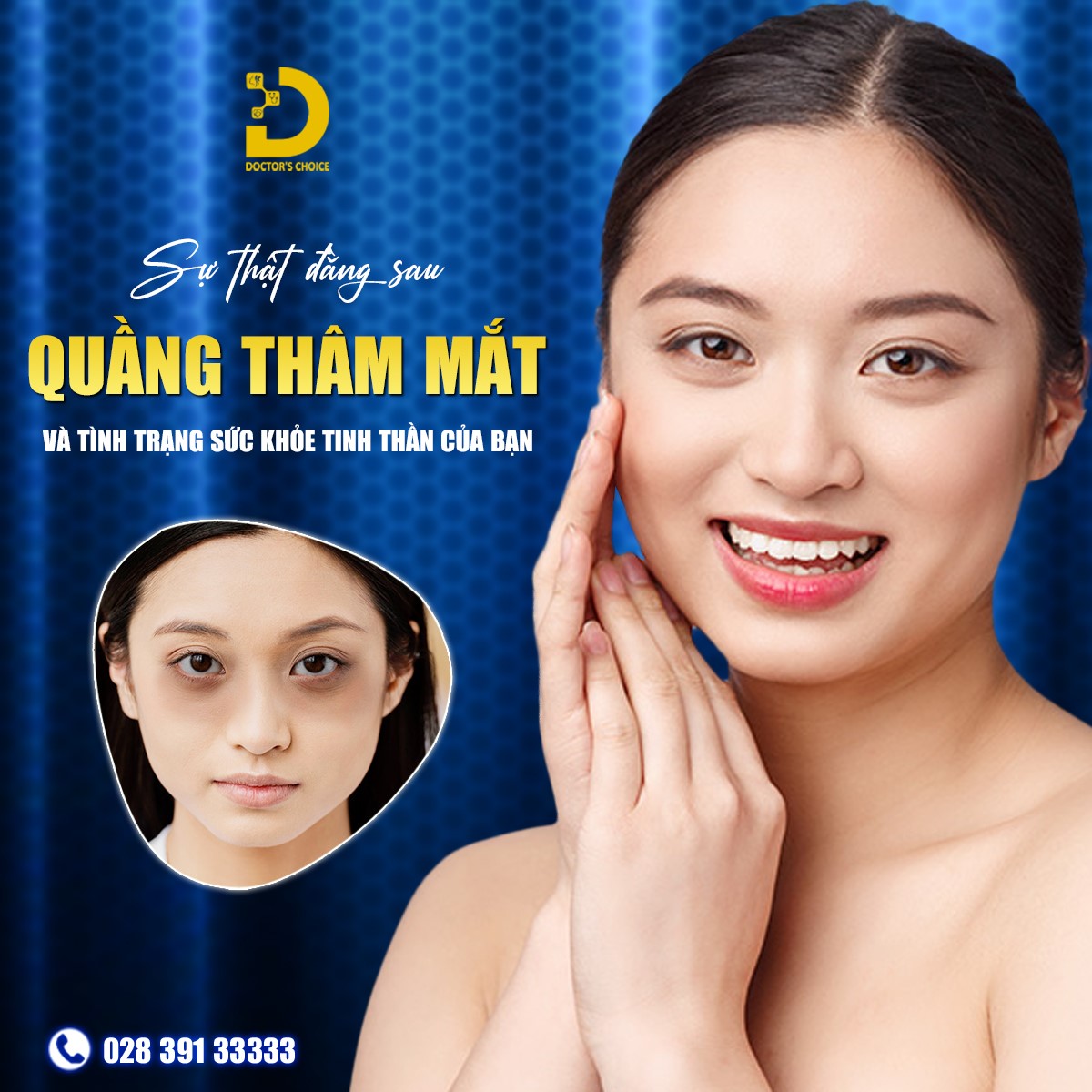 Phòng khám điều trị thâm quầng mắt hiệu quả ở TPHCM 23 Dr.Choice - Phòng Khám Chuẩn Y Khoa Điều Trị Thâm Mắt Hiệu Quả, An Toàn