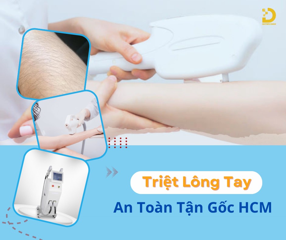 Dịch Vụ Triệt Lông Tay Tận Gốc An Toàn Tại TPHCM 9 Doctor's Choice Clinic có dịch vụ triệt lông tận gốc an toàn hiệu quả