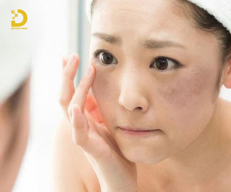 Phòng Khám Điều Trị Nám Nội Tiết Hiệu Quả Tại TPHCM 8 dieu tri nam noi tiet 2