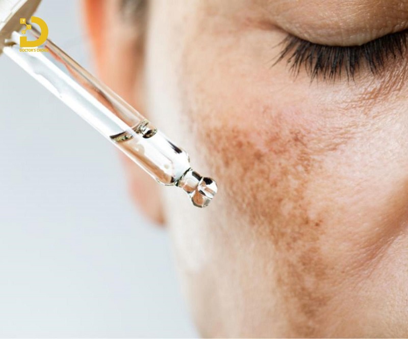 Phòng Khám Điều Trị Nám Nội Tiết Hiệu Quả Tại TPHCM 11 dieu tri nam noi tiet 4