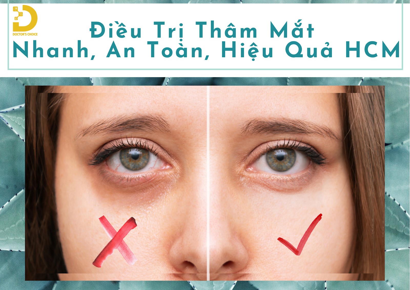 Phòng khám điều trị thâm quầng mắt hiệu quả ở TPHCM 17 Dịch vụ điều trị thâm mắt nhanh chóng, an toàn và hiệu quả