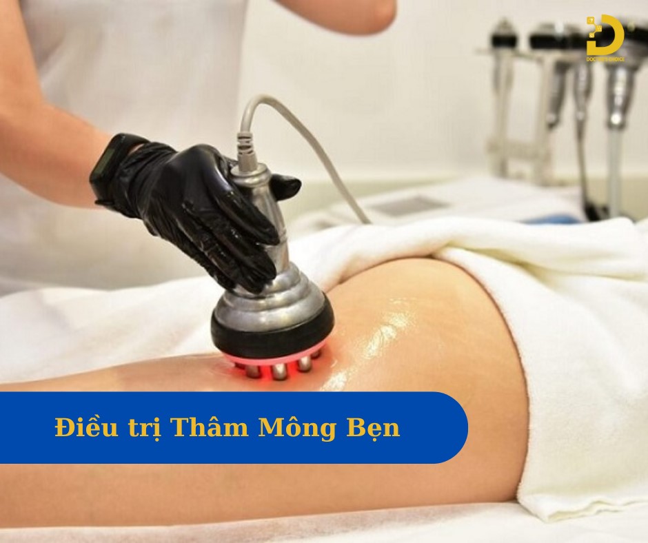 Phòng khám trị thâm mông, bẹn an toàn ở TPHCM 13 Những trường hợp thâm nặng, bạn nên tìm đến các cơ sở thẩm mỹ uy tín để được tư vấn và điều trị