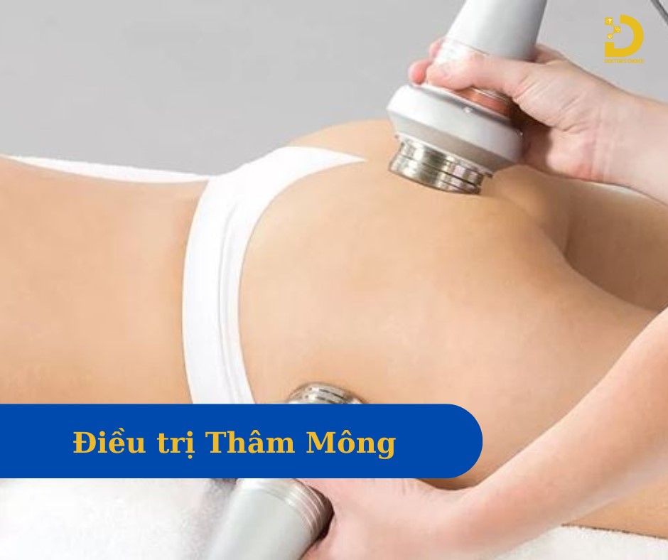 Phòng khám trị thâm mông, bẹn an toàn ở TPHCM 14 Hình ảnh điều trị thâm vùng kín