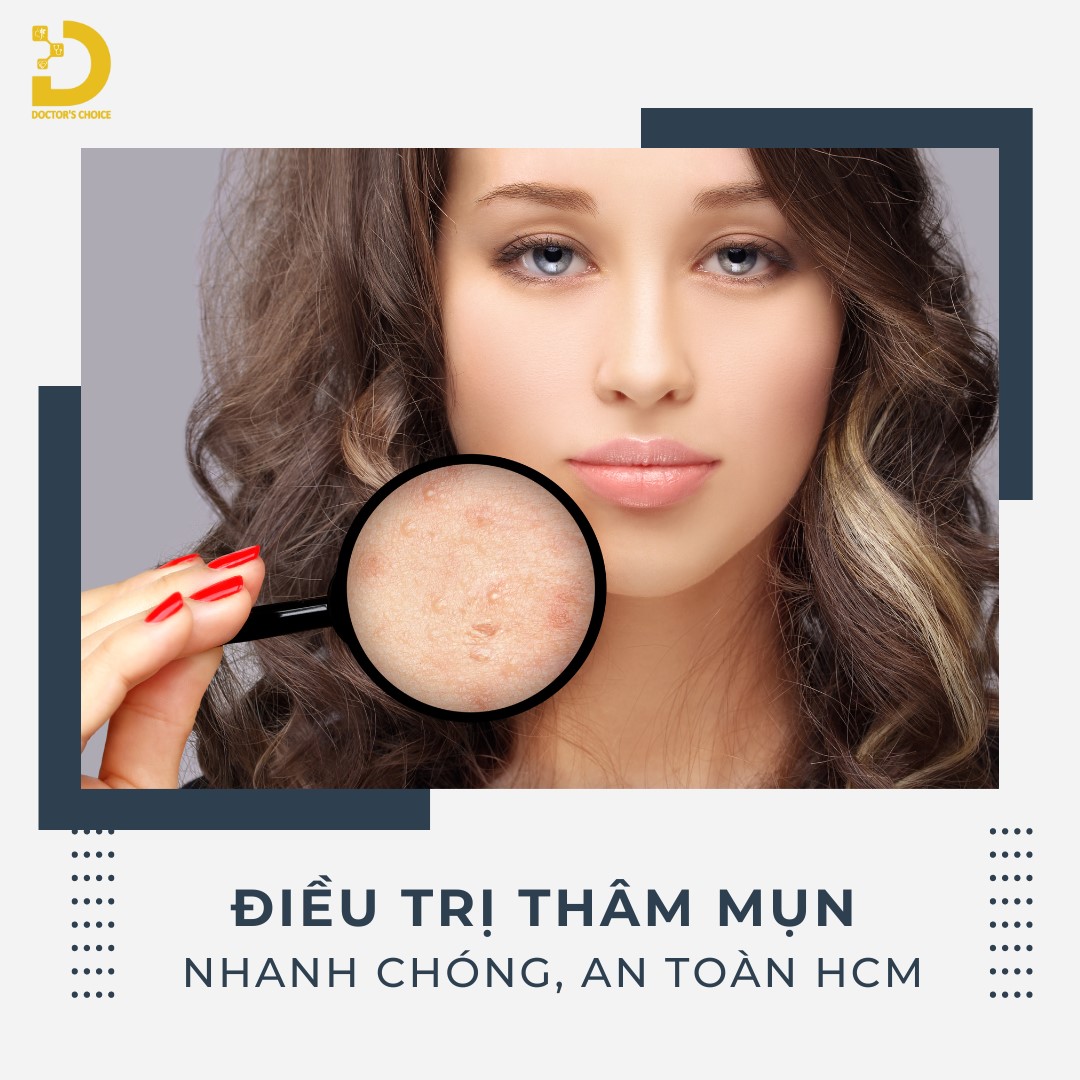 Phòng Khám Thâm Mụn Tại HCM An Toàn, Hiệu Quả 12 Doctor's Choice Clinic mang đến dịch vụ điều trị thâm mụn nhanh chóng, an toàn tại TP.HCM