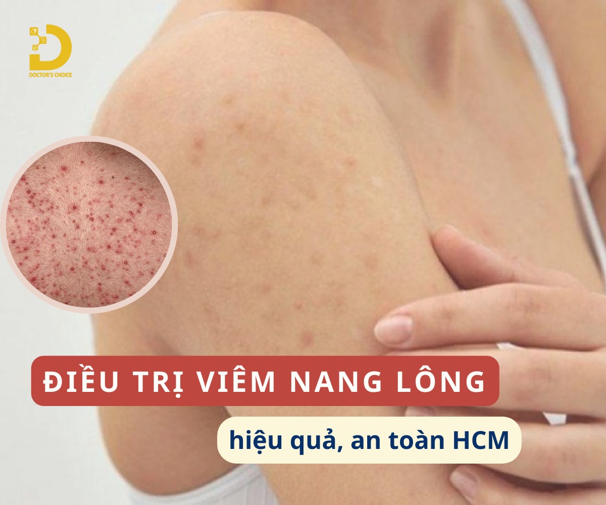 Phòng Khám Điều Trị Viêm Nang Lông Hiệu Quả, An Toàn Tại TPHCM 9 Dịch vụ điều trị viêm nang lông