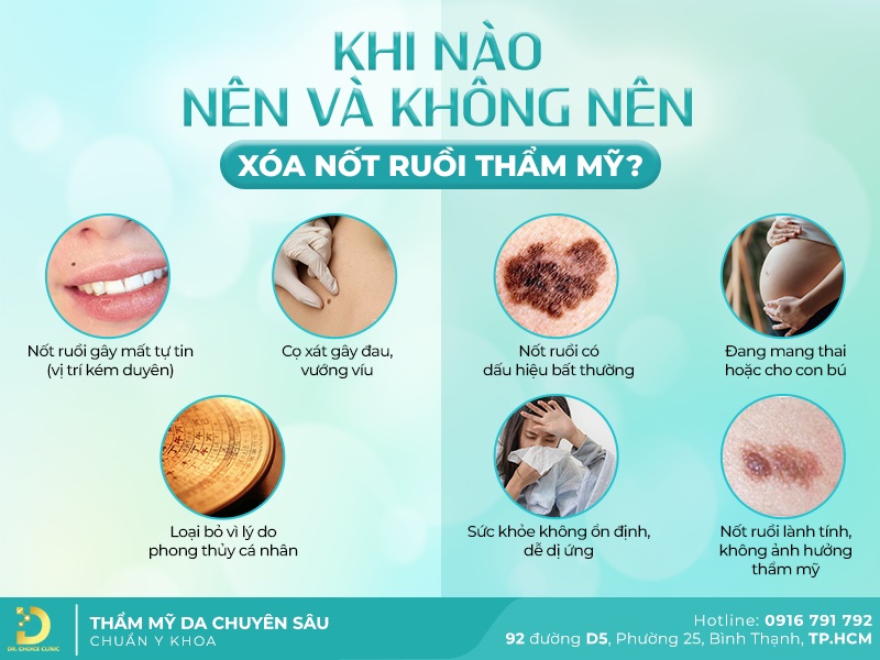 Dịch Vụ Xóa Nốt Ruồi Thẩm Mỹ Uy Tín, An Toàn TPHCM 8 khi nao nen va khong nen xoa not ruoi