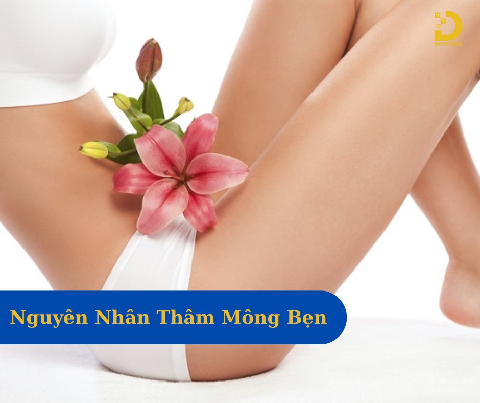 Phòng khám trị thâm mông, bẹn an toàn ở TPHCM 11 Thay đổi nội tiết tố, chưa vệ sinh cơ thể tốt, ma sát, chế độ sinh hoạt là nguyên nhân gây thâm vùng kín (mông, bẹn)