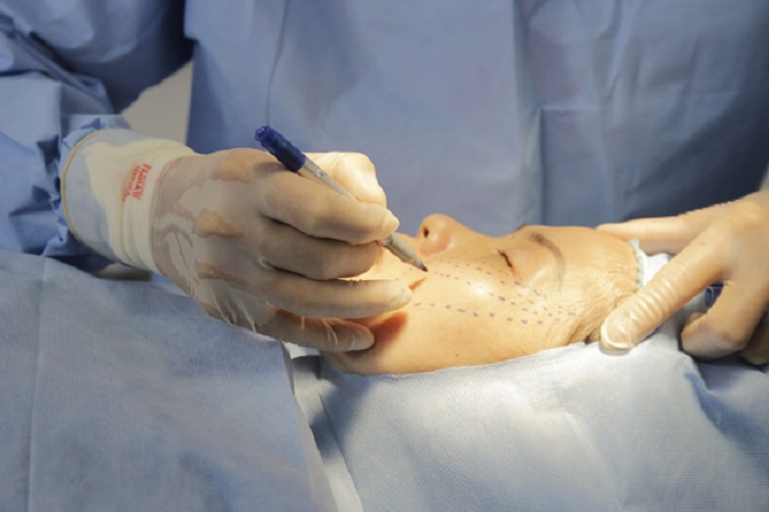 Nâng Cơ, Trẻ Hóa Da Mặt Nhanh, An Toàn Chuẩn Y Khoa HCM 22 Phương pháp nâng cơ, trẻ hóa da bằng phẫu thuật