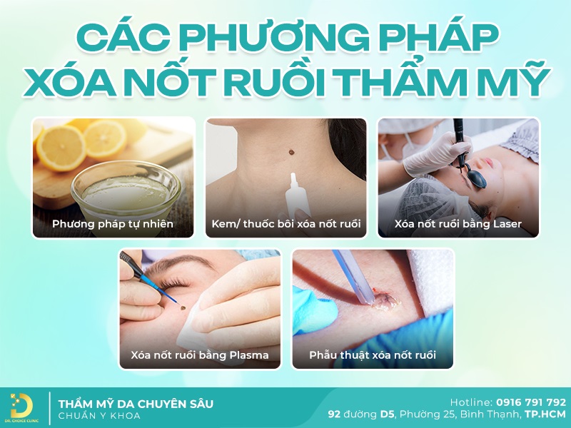 Dịch Vụ Xóa Nốt Ruồi Thẩm Mỹ Uy Tín, An Toàn TPHCM 9 phuong phap xoa not ruoi tham my