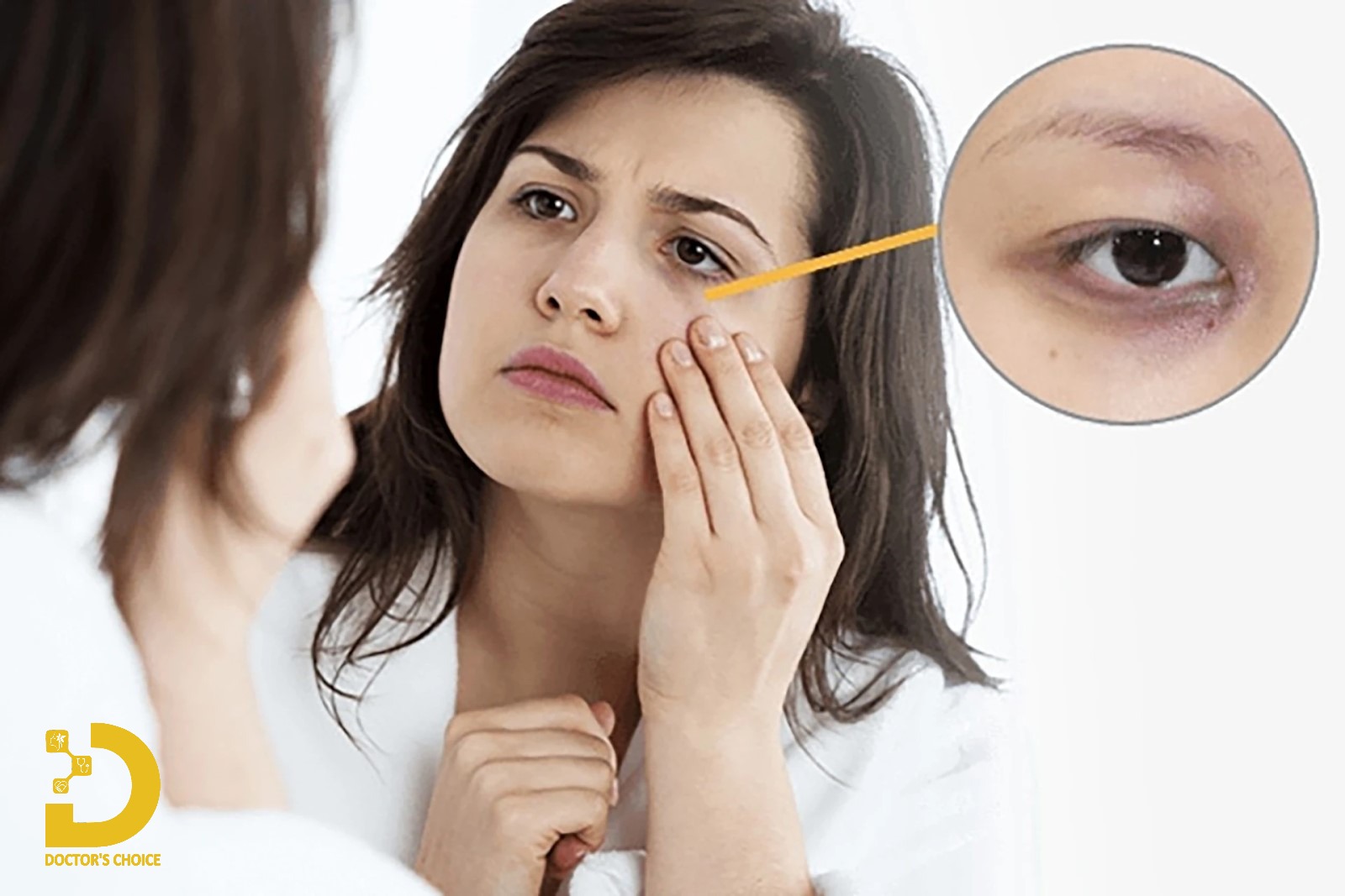 Phòng khám điều trị thâm quầng mắt hiệu quả ở TPHCM 19 Quầng thâm mắt không chỉ ảnh hưởng đến cả sinh lý và tâm lý