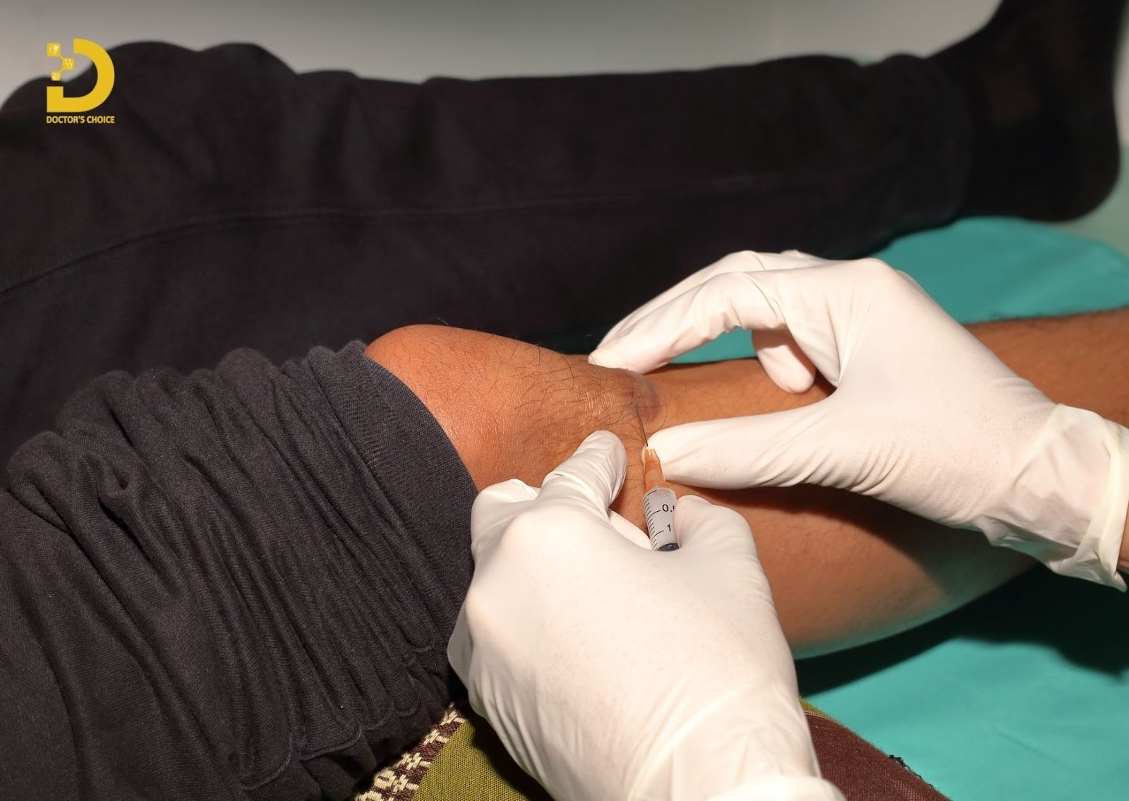 Phòng khám trị sẹo lồi, sẹp phì đại tại TPHCM an toàn, hiệu quả 24 Tiêm là một phương pháp điều trị sẹo lồi hiệu quả