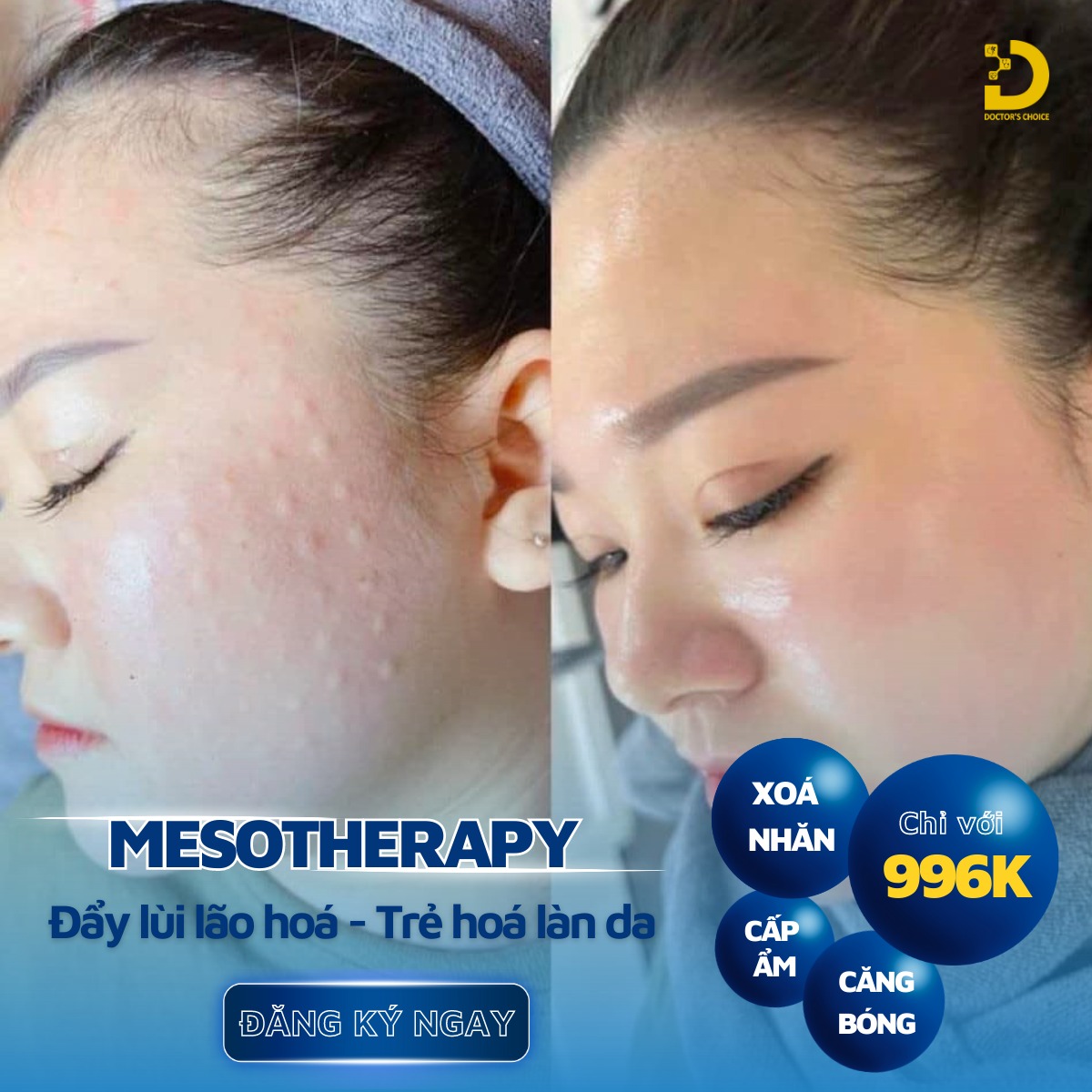 Nâng Cơ, Trẻ Hóa Da Mặt Nhanh, An Toàn Chuẩn Y Khoa HCM 27 Doctor's Choice Clinic nổi bật với nhiều ưu điểm vượt trội trong lĩnh vực nâng cơ và trẻ hóa da mặt