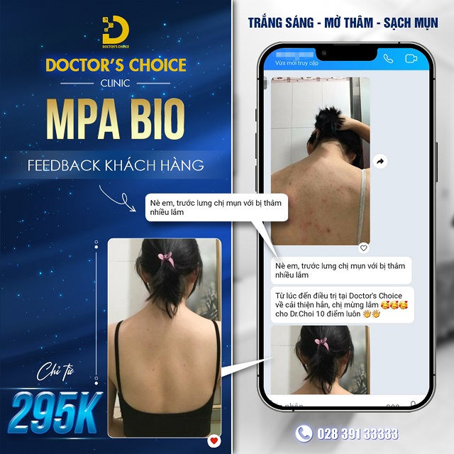 Điều Trị Mụn Lưng An Toàn, Vệ Sinh Chuẩn Y Khoa TPHCM 22 Điều trị mụn lưng bằng công nghệ MPA BIO