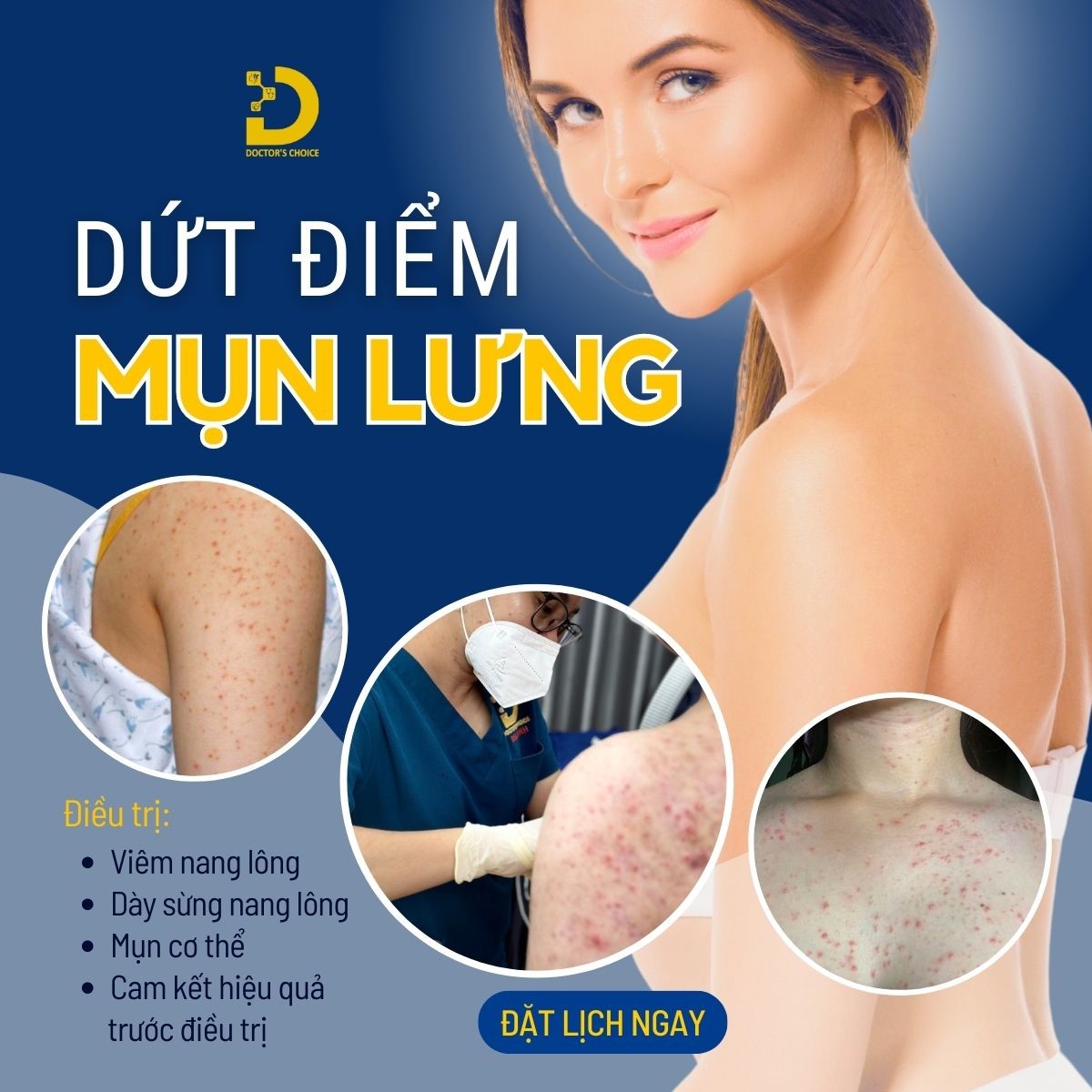 Điều Trị Mụn Lưng An Toàn, Vệ Sinh Chuẩn Y Khoa TPHCM 24 Dịch vụ trị mụn lưng tại Dr.Choice được khách hàng ở HCM tin tưởng, đánh giá cao
