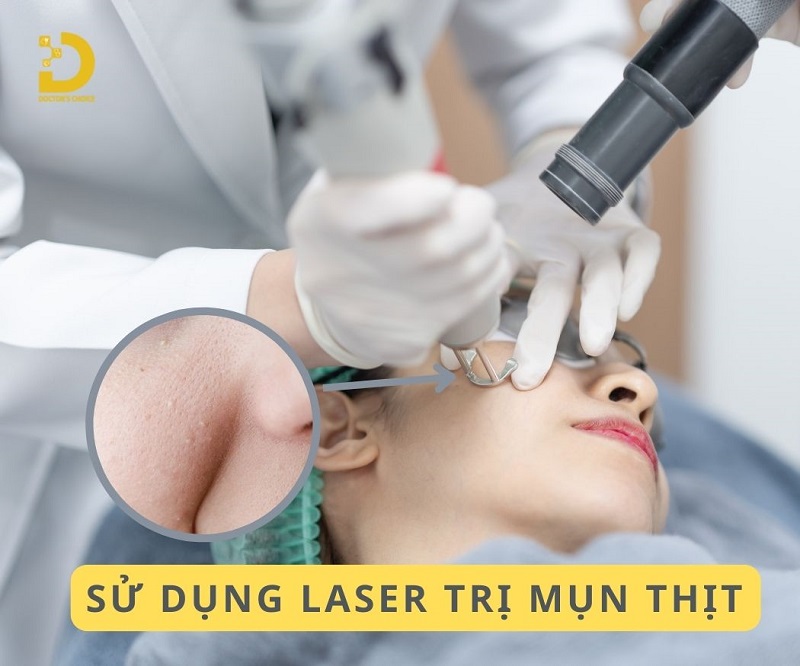 Phòng Khám Điều Trị Mụn Thịt An Toàn, Hiệu Quả TPHCM 21 tri mun thit 10