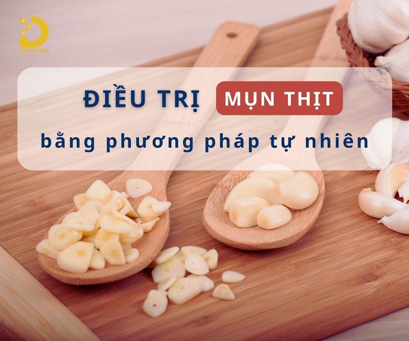 Phòng Khám Điều Trị Mụn Thịt An Toàn, Hiệu Quả TPHCM 17 tri mun thit 5