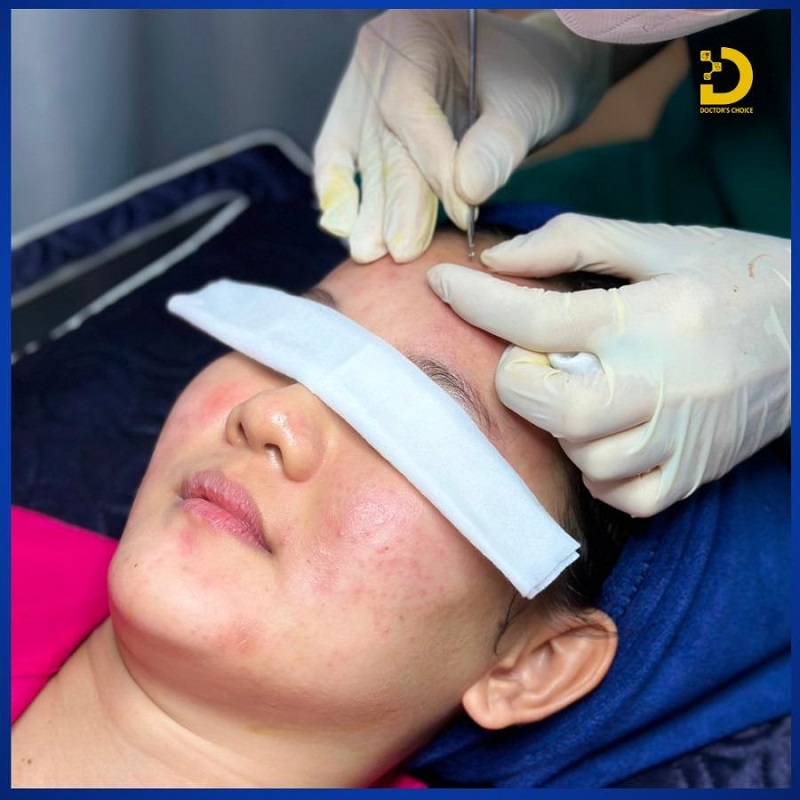 Phòng Khám Điều Trị Mụn Viêm An Toàn, Vệ Sinh TPHCM 12 tri mun viem 3