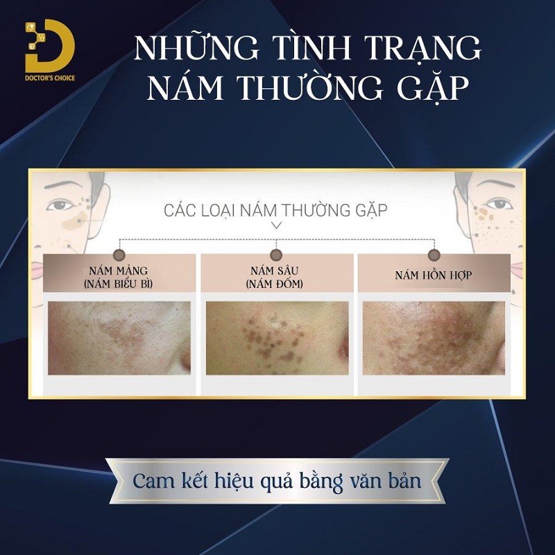 Phòng Khám Điều Trị Nám Mảng Tận Gốc, An Toàn Tại TPHCM 11 tri nam mang 2