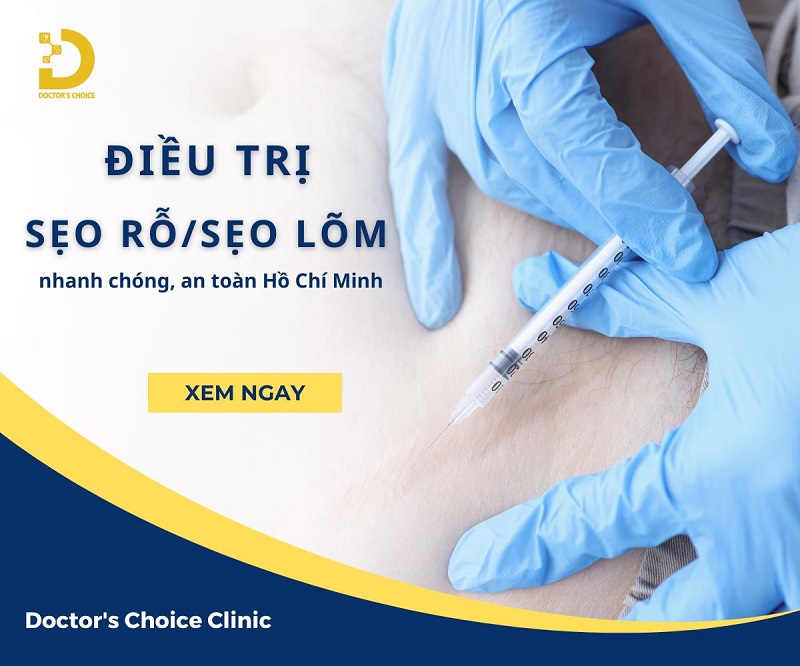 Phòng khám điều trị sẹo rỗ, sẹo lõi nhanh, an toàn tại TPHCM 21 Dịch vụ điều trị sẹo rỗ/ sẹo lõm nhanh, an toàn tại HCM