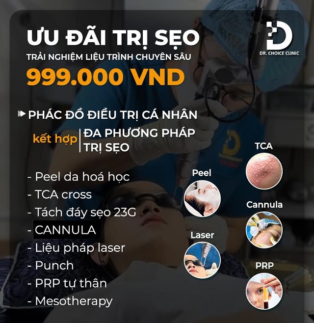 Phòng khám điều trị sẹo rỗ, sẹo lõi nhanh, an toàn tại TPHCM 28 tri seo ro seo lom 9