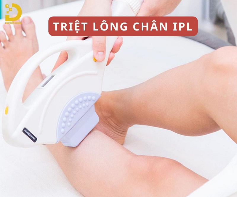 Dịch Vụ Triệt Lông Chân Nam, Nữ An Toàn, Giá Tận Gốc Tại TPHCM 9 triet long chan 3
