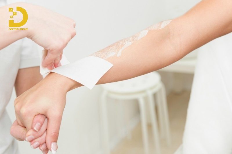 Dịch Vụ Triệt Lông Tay Tận Gốc An Toàn Tại TPHCM 11 Wax lông là một trong những phương pháp phổ biến nhất để loại bỏ lông trên các vùng da rộng như tay tại nhà.