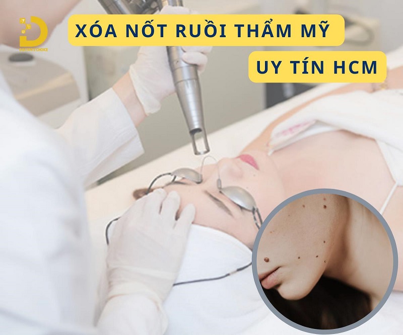 Dịch Vụ Xóa Nốt Ruồi Thẩm Mỹ Uy Tín, An Toàn TPHCM 6 xoa not ruoi tham my 1