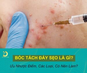 boc tach day seo 1
