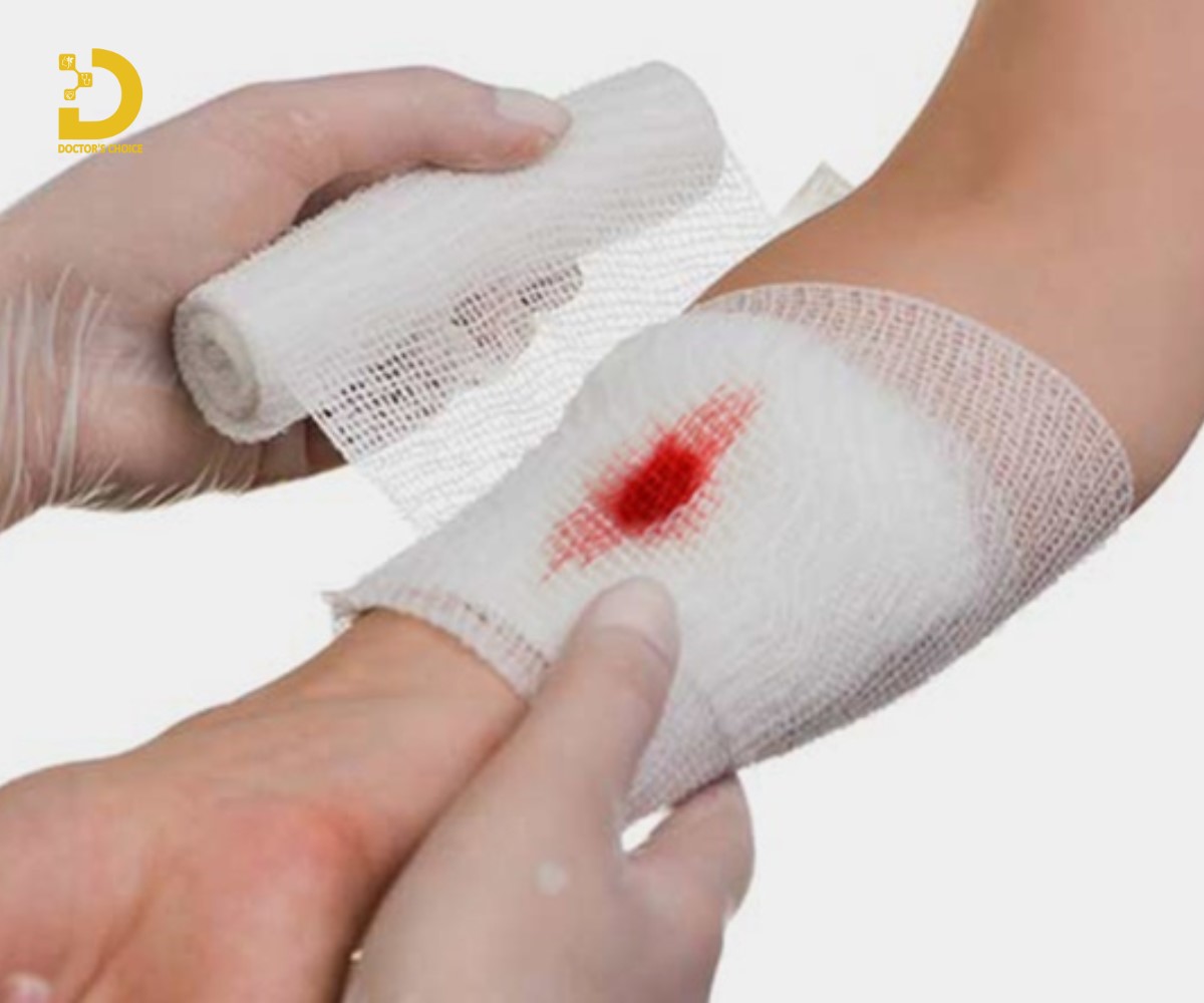Cách Trị Vết Thương Không Để Lại Sẹo Hiệu Quả 16 Băng bó vết thương không để lại sẹo