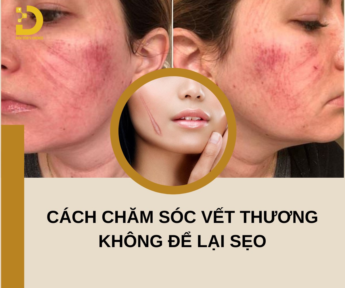 Cách Trị Vết Thương Không Để Lại Sẹo Hiệu Quả 10 Cách chăm sóc vết thương không để lại sẹo