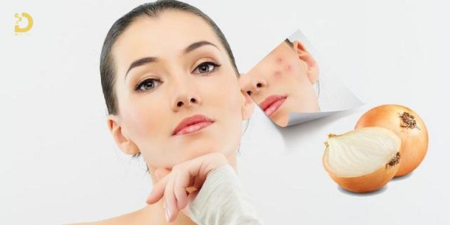 Top 7+ Cách Điều Trị Sẹo Tại Nhà An Toàn, Hiệu Quả 14 cach tri seo tai nha 4