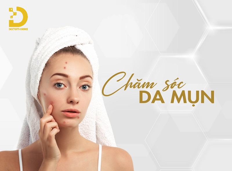 Mụn Đầu Đen Là Gì? Nguyên Nhân, Cách Chăm Sóc Và Điều Trị 14 Chăm sóc da mụn đầu đen đúng cách