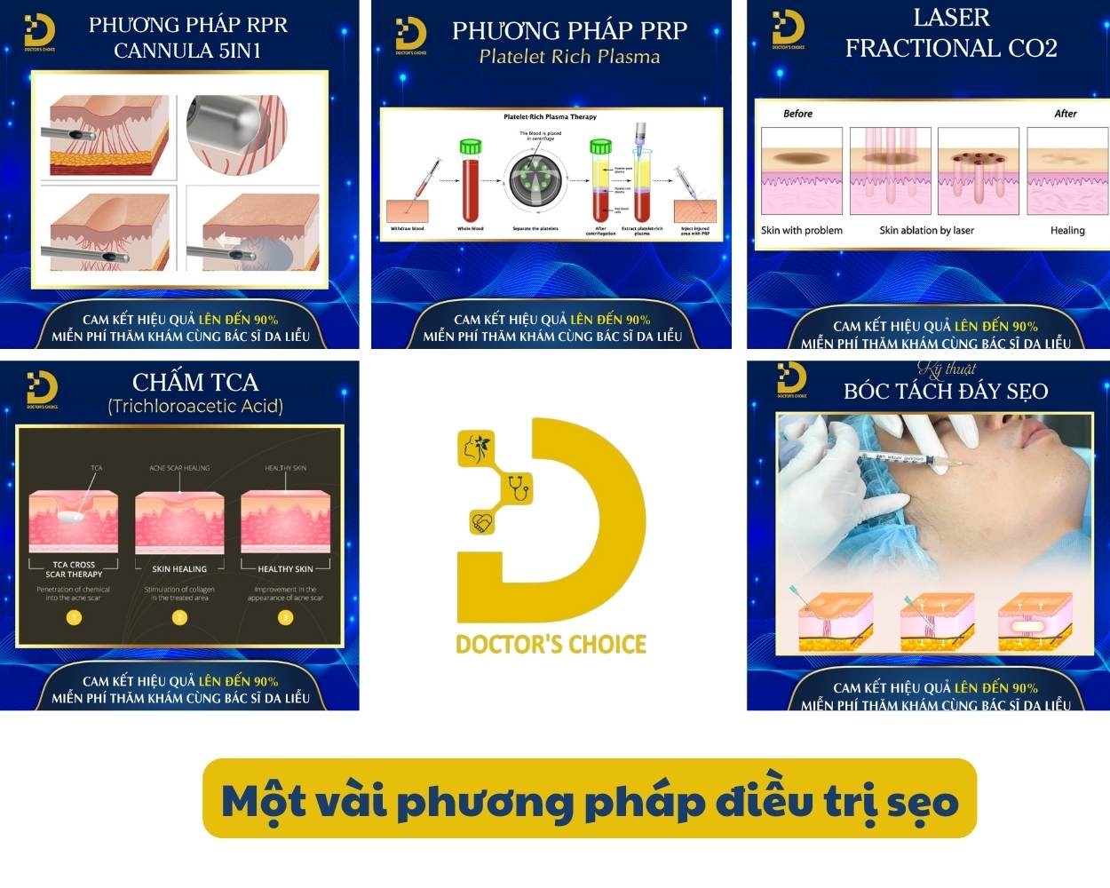 Chi Phí Điều Trị Sẹo Phụ Thuộc Vào Yếu Tố Nào? Bảng Giá Tham Khảo 11 Các phương pháp điều trị sẹo phổ biến nhất hiện nay