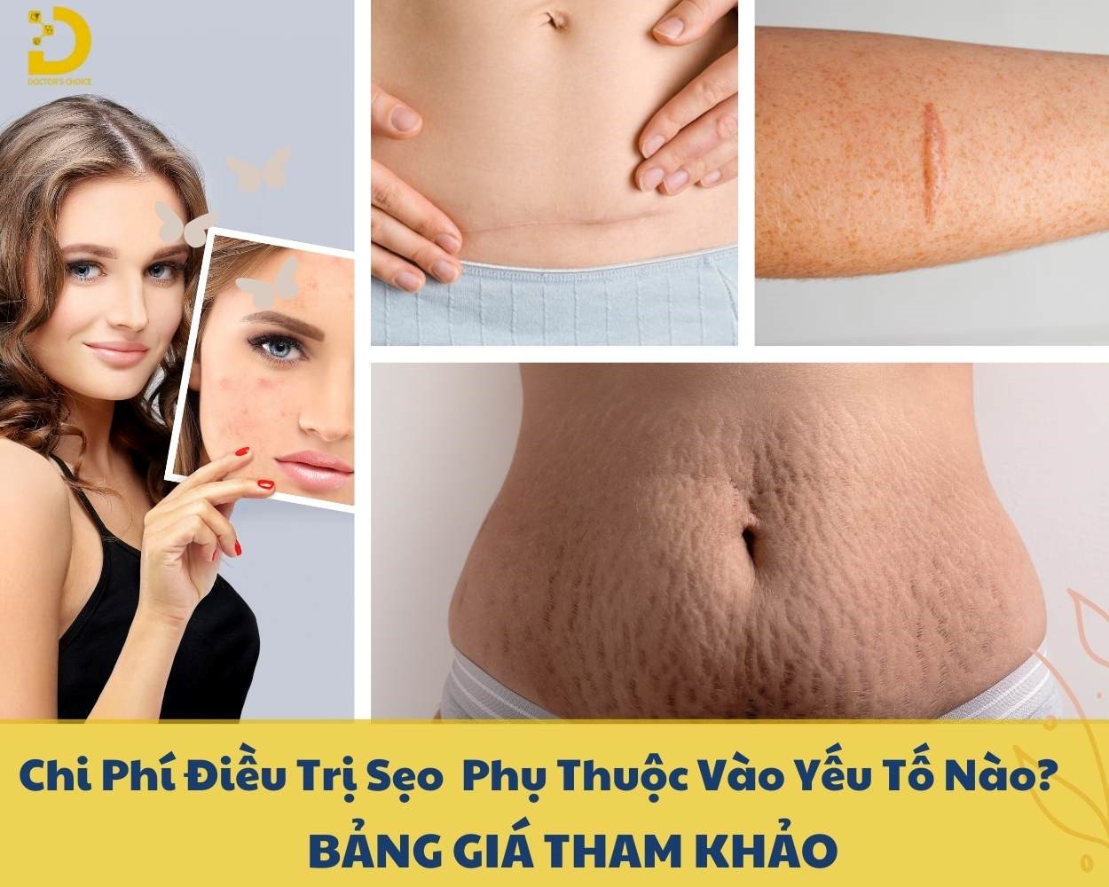 Chi Phí Điều Trị Sẹo Phụ Thuộc Vào Yếu Tố Nào? Bảng Giá Tham Khảo 9 Các yếu tố ảnh hưởng đến chi phí điều trị sẹo