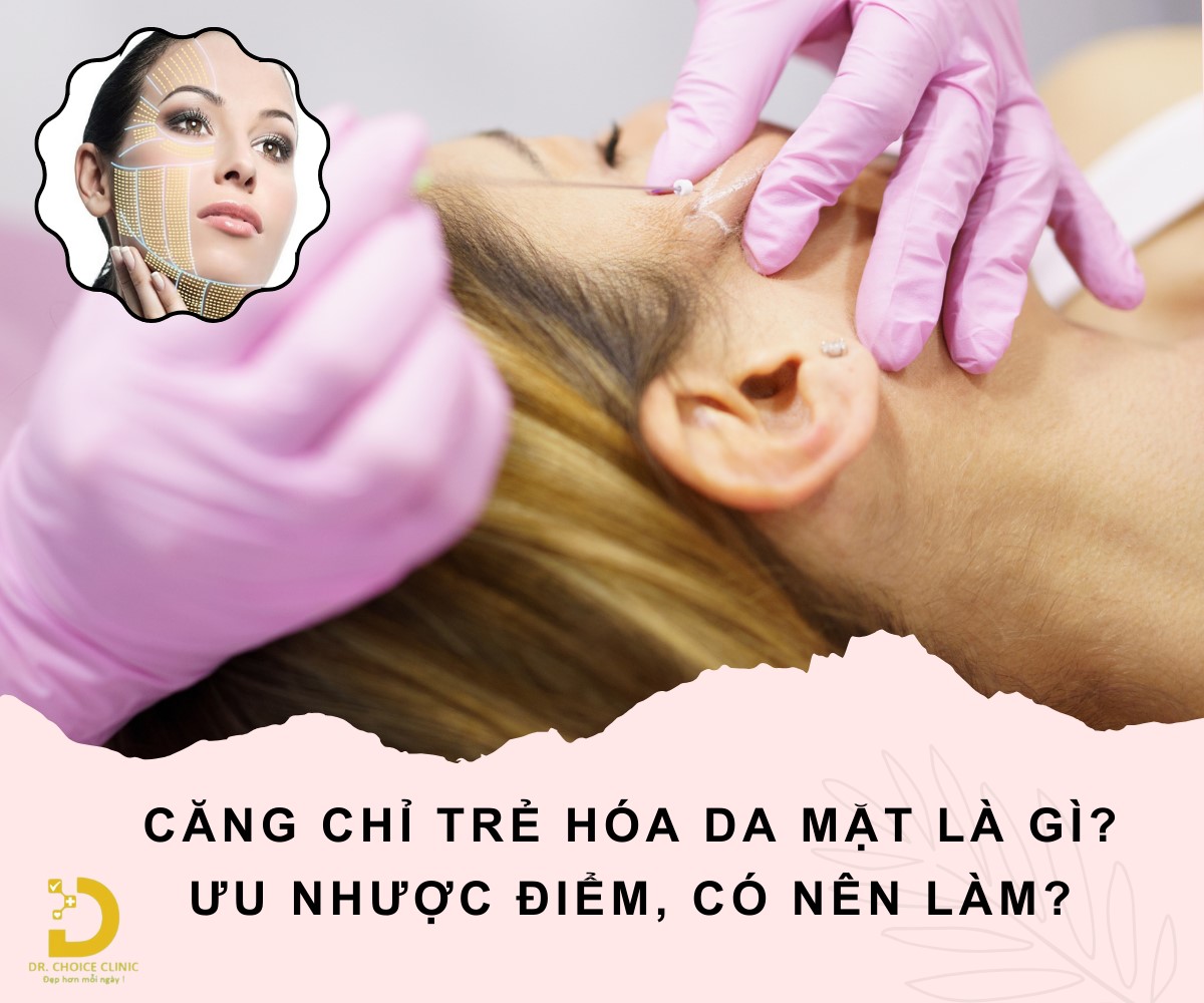 Căng Chỉ Trẻ Hóa Da Mặt Là Gì? Ưu Nhược Điểm, Có Nên Làm? 8 Tìm hiểu về công nghệ công nghệ căng chỉ trẻ hóa da