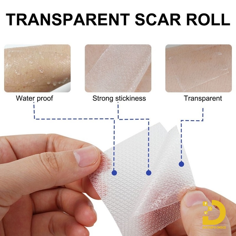 Sẹo Phì Đại Là Gì? Dấu Hiệu Nhận Biết Và Cách Điều Trị 14 Phương pháp đắp gel silicone trị sẹo phì đại
