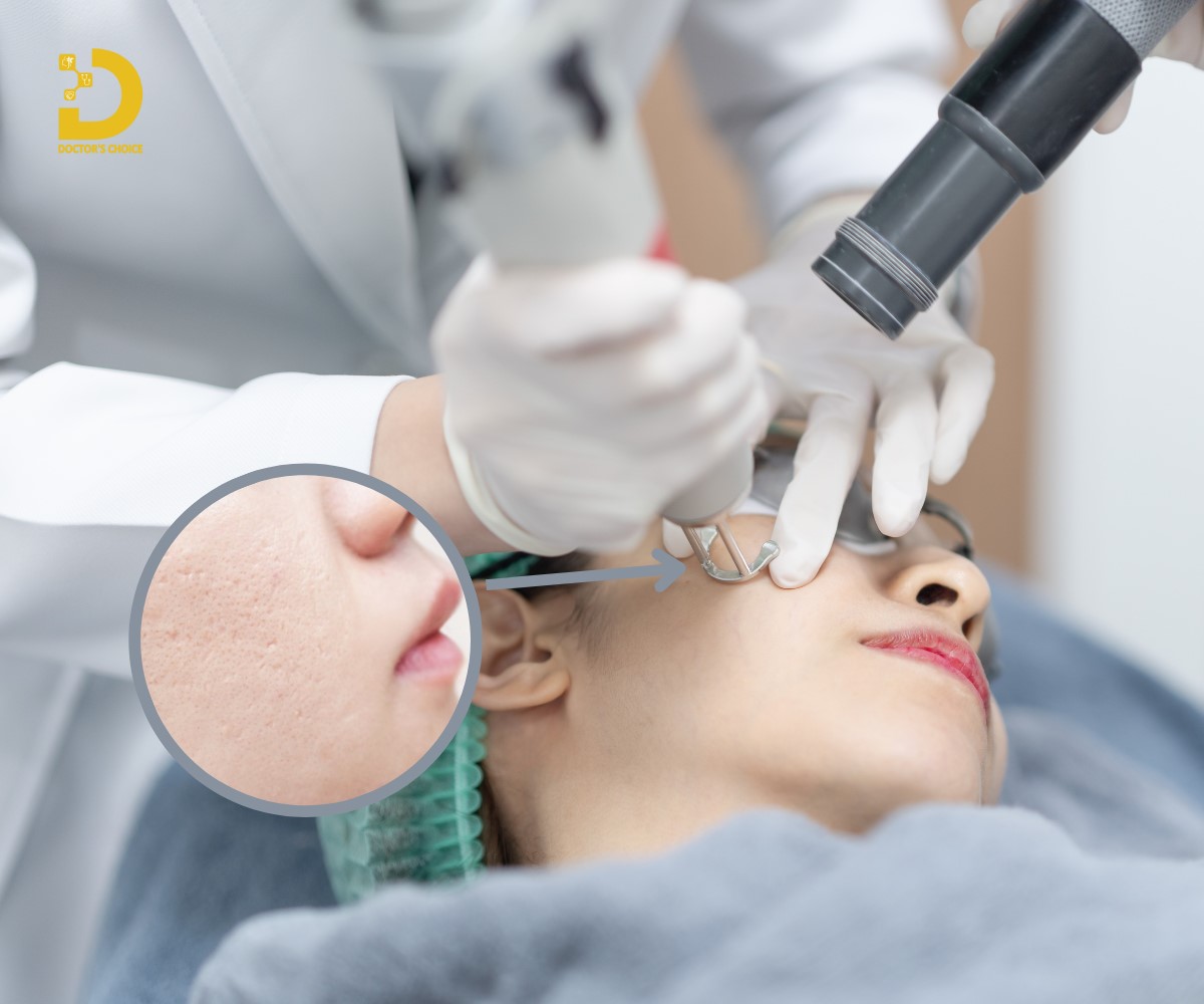 Nhận Diện Các Loại Sẹo Thường Gặp Và Cách Điều Trị Hiệu Quả 23 Phương pháp điều trị sẹo bằng laser