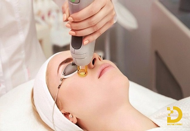 Mụn Đầu Đinh: Nguyên Nhân, Cách Nhận Biết và Điều Trị Hiệu Quả 19 Phương pháp trị mụn đầu đinh bằng laser