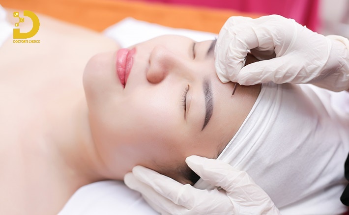 Các Loại Mụn Thường Gặp: Cách Phân Biệt & Điều Trị Phù Hợp 35 Lấy nhân mụn chuẩn y khoa