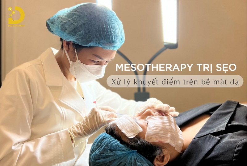 Sẹo Giãn Là Gì? Cách Phòng Ngừa Và Điều Trị Hiệu Quả 16 Điều trị sọe giãn bằng phương pháp Mesotherapy