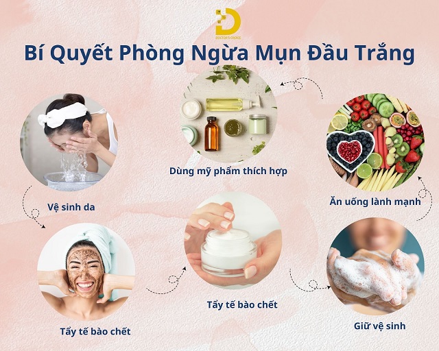 Mụn Đầu Trắng: Nguyên Nhân, Cách Phòng Ngừa Và Điều Trị 11 mun dau trang 5