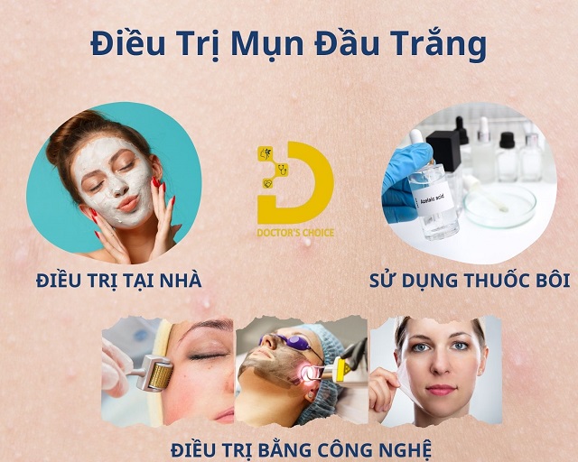 Mụn Đầu Trắng: Nguyên Nhân, Cách Phòng Ngừa Và Điều Trị 12 mun dau trang 6