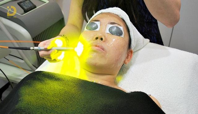 Mụn Nang Là Gì? Nguyên Nhân Và Cách Điều Trị Hiệu Quả 10 mun nang 4