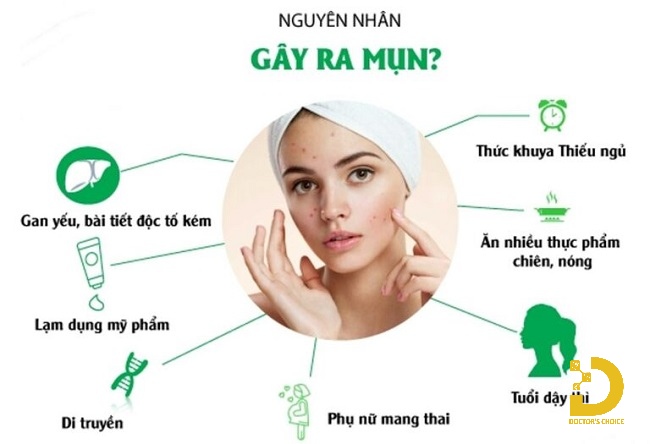 Mụn Cám: Nguyên Nhân, Cách Nặn Mụn & Điều Trị Hiệu Quả 11 Tại sao da bị mụn cám