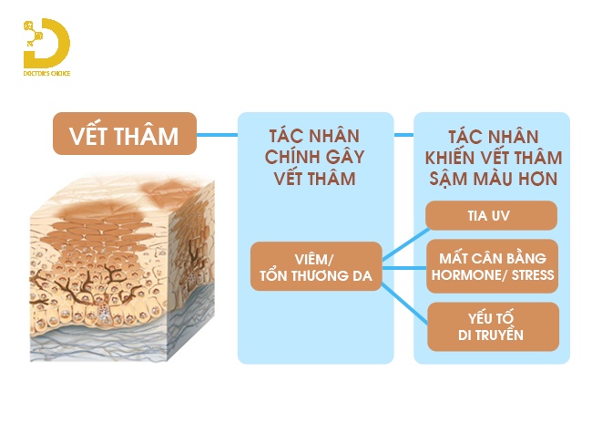 Thâm Da Do Đâu? Các Loại Thâm Da Thường Gặp Và Cách Điều Trị Hiệu Quả 12 Nguyên nhân gây ra tình trạng da thâm