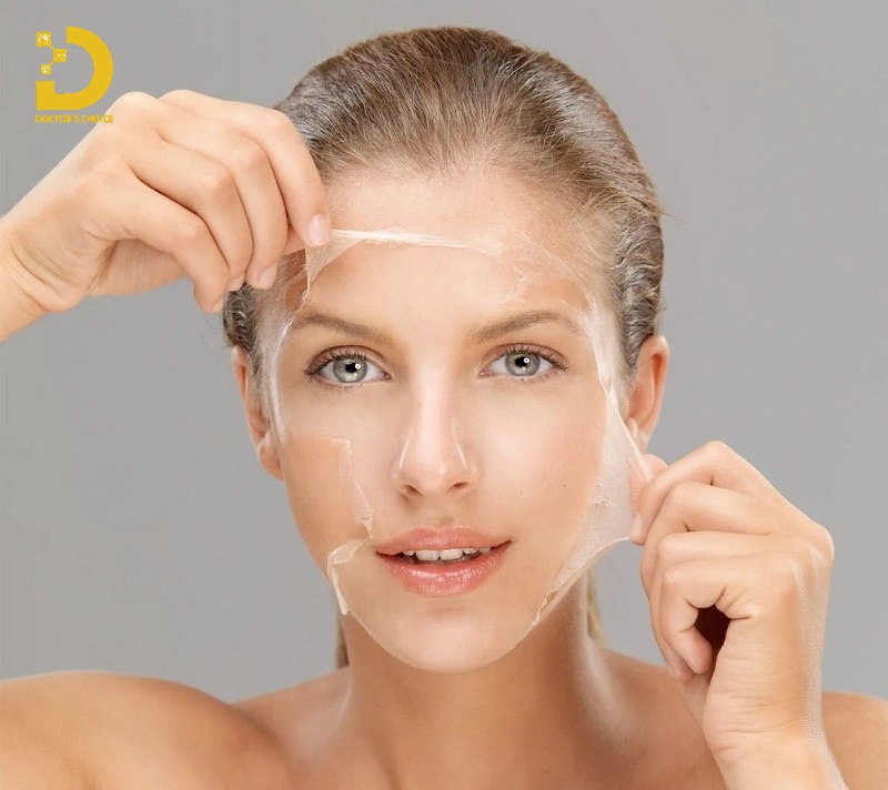 Thâm Mụn Có Tự Hết Không? Cách Phòng Ngừa Và Điều Trị Hiệu Quả 18 Peel da điều trị thâm mụn