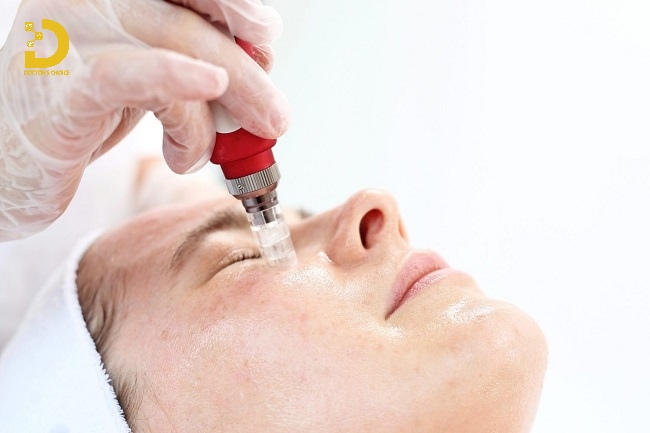 Nhận Diện Các Loại Sẹo Thường Gặp Và Cách Điều Trị Hiệu Quả 27 Phương pháp phi kim điều trị sẹo